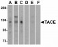 PIST Antibody